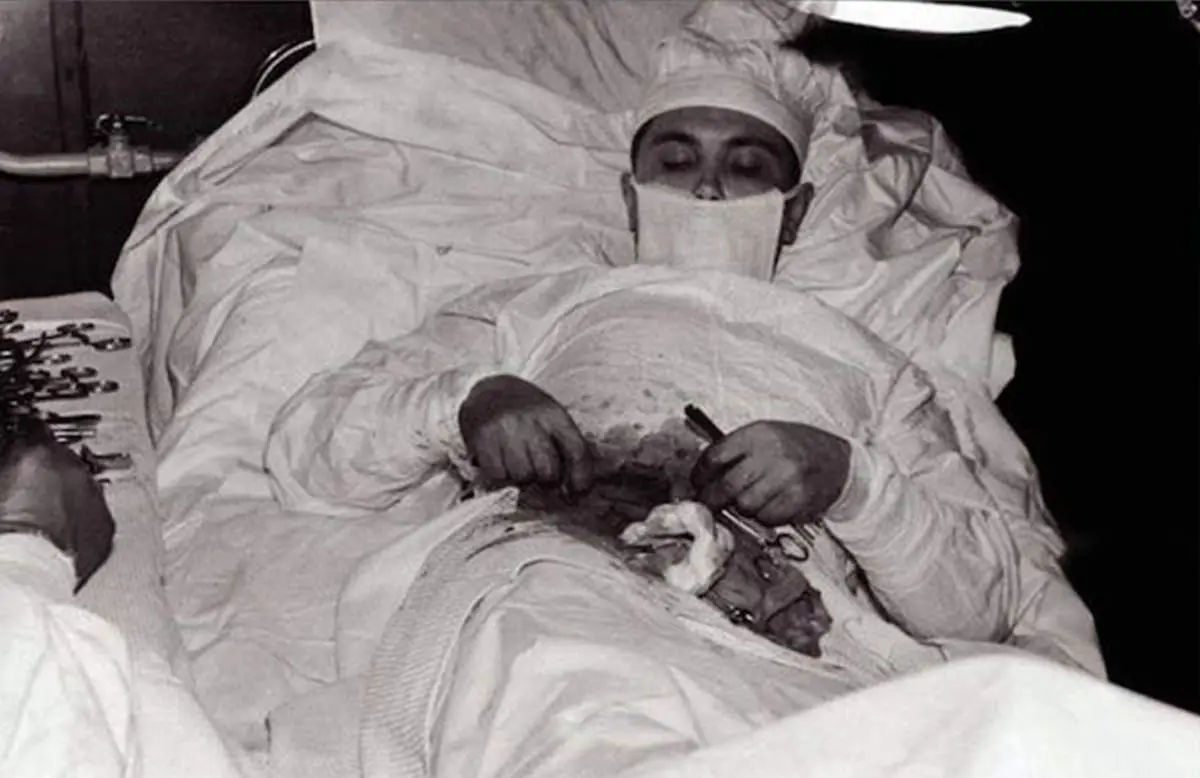 Leonid Rogozov self surgery in Antarctica